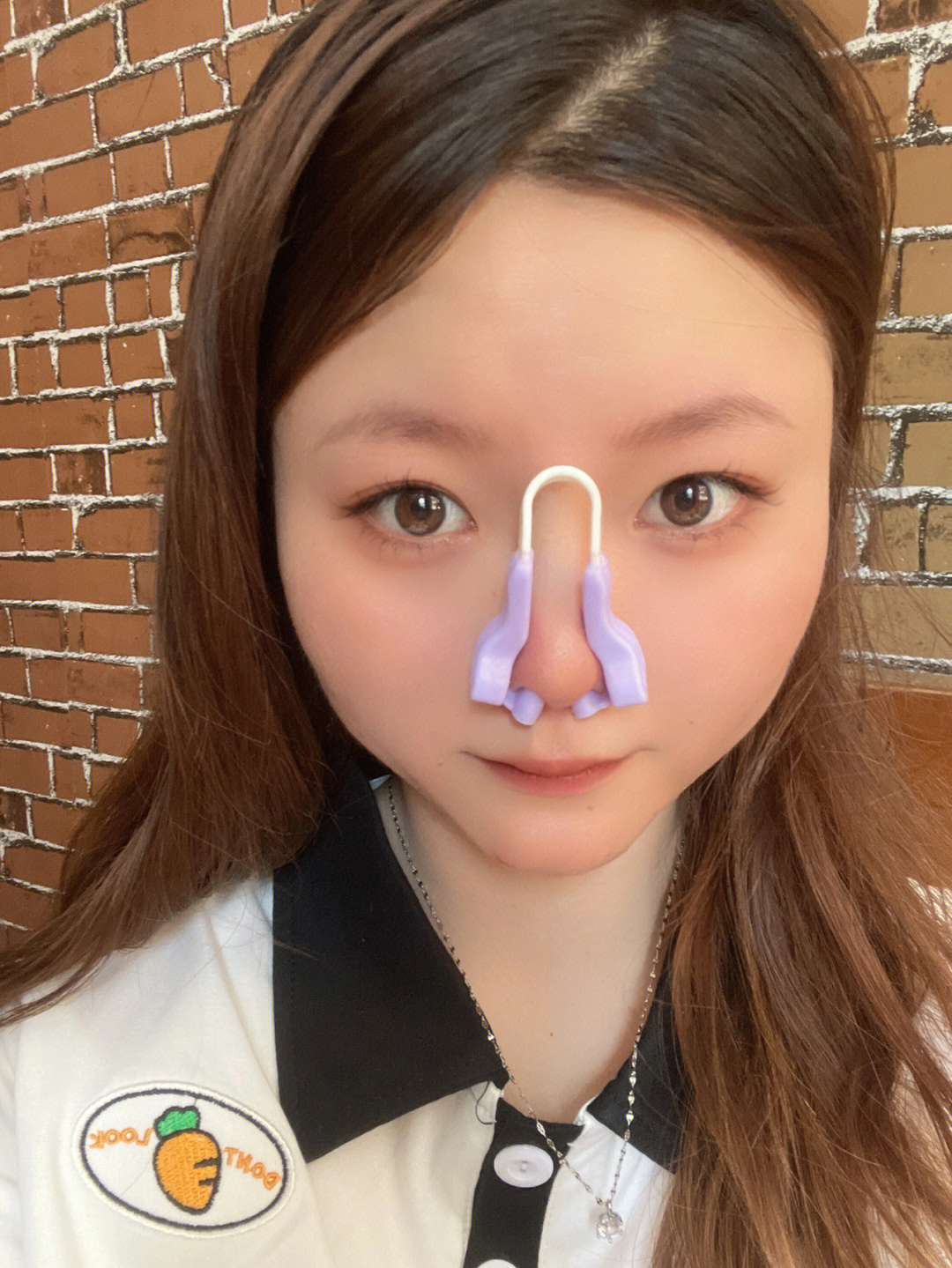上海丽质美学整形【塌鼻做鼻综合前后对比】-塌鼻子手术矫正 - 知乎